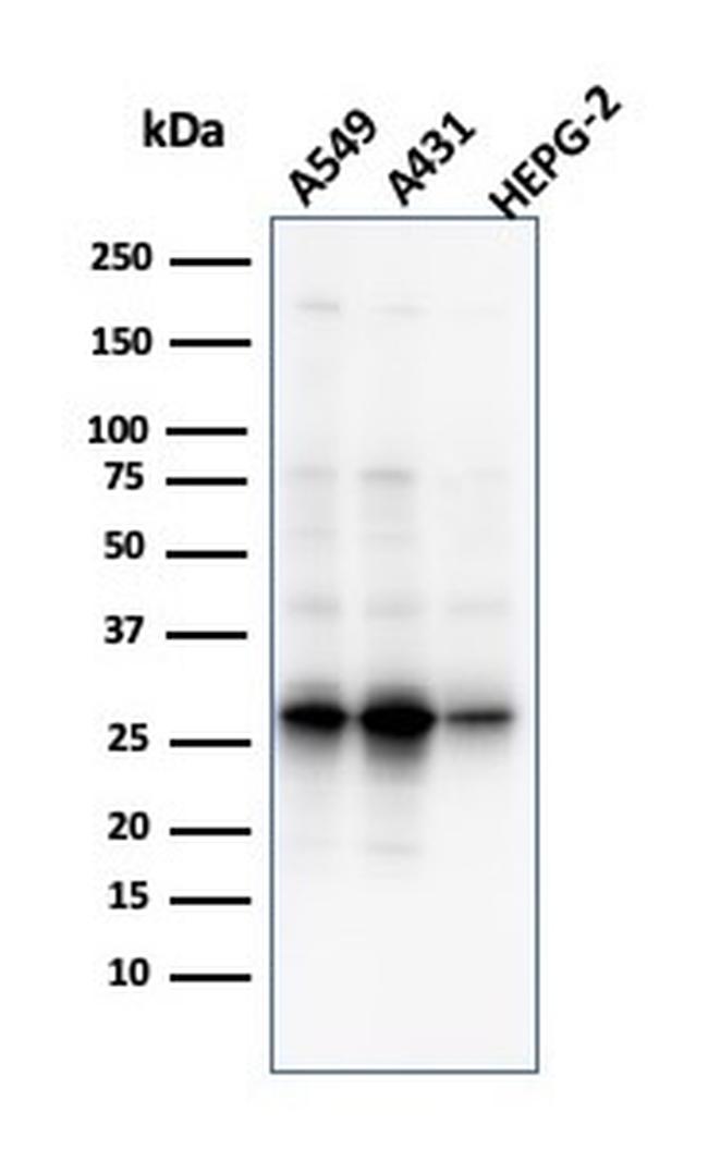 Glutamate-Cysteine Ligase Regulatory Subunit Antibody in Western Blot (WB)