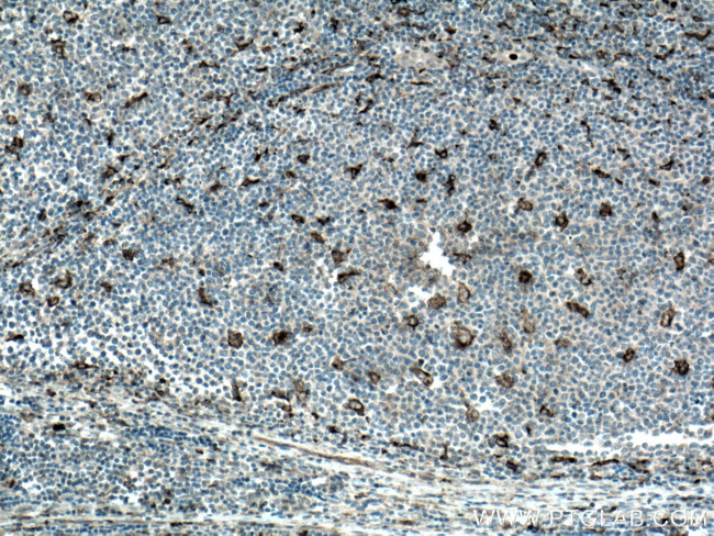 MMP9 Antibody in Immunohistochemistry (Paraffin) (IHC (P))