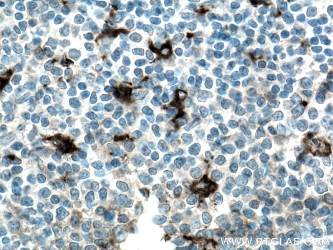 MMP9 Antibody in Immunohistochemistry (Paraffin) (IHC (P))