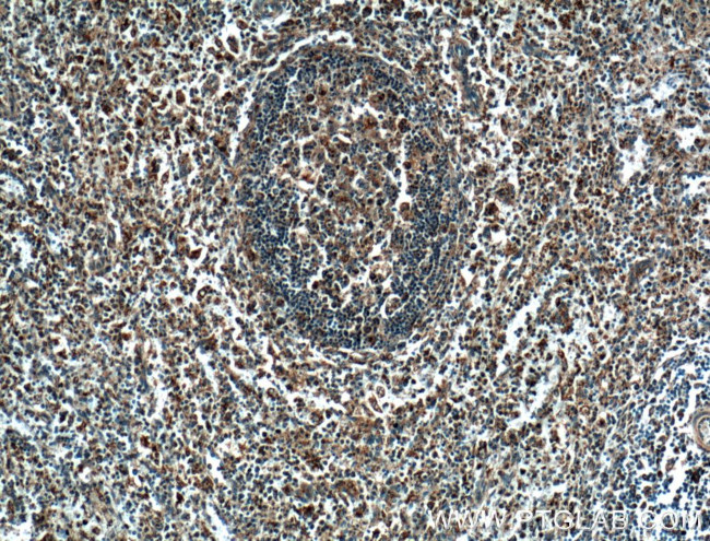 COX2/ Cyclooxygenase 2 Antibody in Immunohistochemistry (Paraffin) (IHC (P))