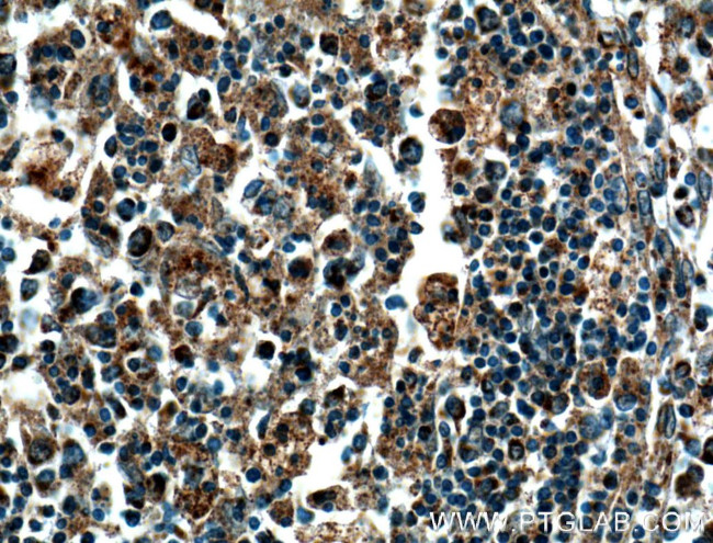 COX2/ Cyclooxygenase 2 Antibody in Immunohistochemistry (Paraffin) (IHC (P))