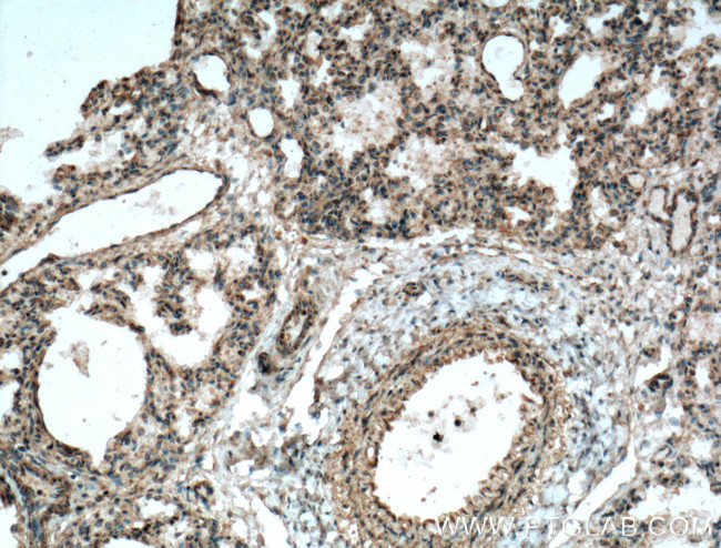 COX2/ Cyclooxygenase 2 Antibody in Immunohistochemistry (Paraffin) (IHC (P))