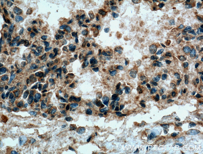 COX2/ Cyclooxygenase 2 Antibody in Immunohistochemistry (Paraffin) (IHC (P))