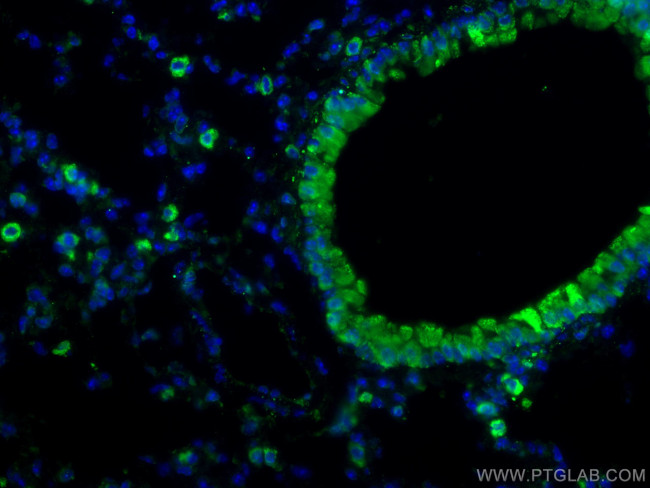 COX2/ Cyclooxygenase 2 Antibody in Immunohistochemistry (PFA fixed) (IHC (PFA))