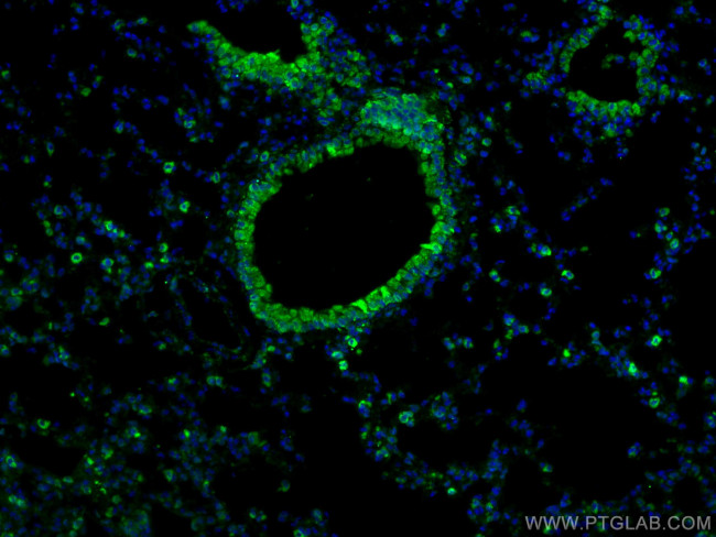 COX2/ Cyclooxygenase 2 Antibody in Immunohistochemistry (PFA fixed) (IHC (PFA))