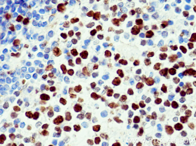 KI67 Antibody in Immunohistochemistry (Paraffin) (IHC (P))