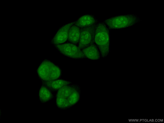 KI67 Antibody in Immunocytochemistry (ICC/IF)