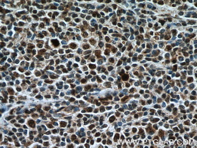 KI67 Antibody in Immunohistochemistry (Paraffin) (IHC (P))