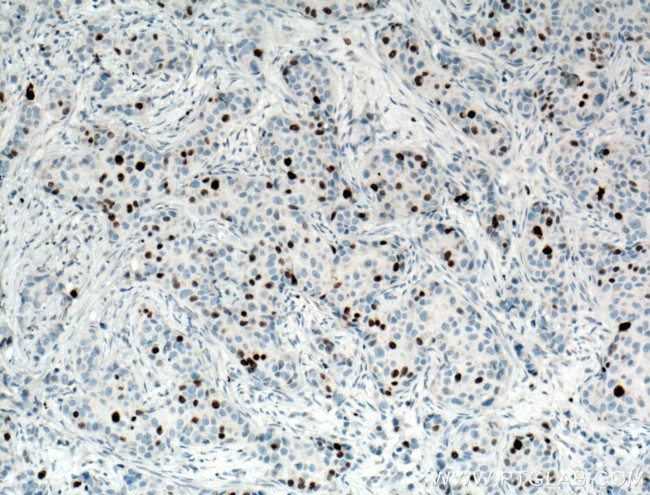 KI67 Antibody in Immunohistochemistry (Paraffin) (IHC (P))