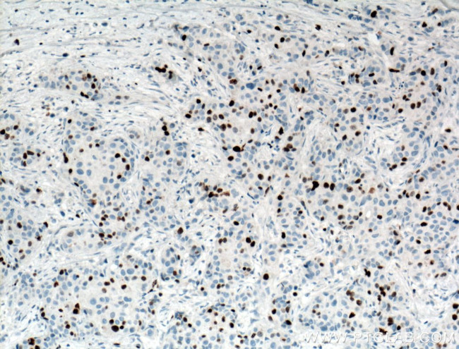 KI67 Antibody in Immunohistochemistry (Paraffin) (IHC (P))