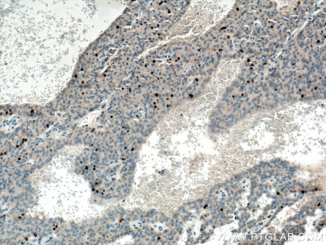 KI67 Antibody in Immunohistochemistry (Paraffin) (IHC (P))