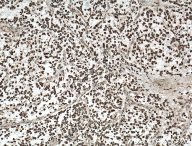 KI67 Antibody in Immunohistochemistry (Paraffin) (IHC (P))