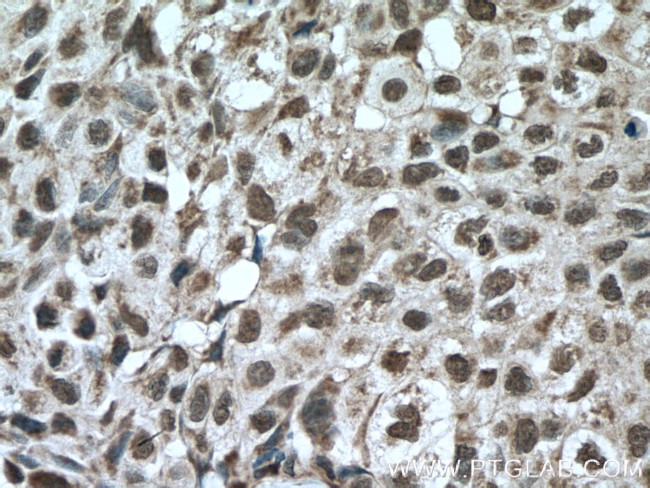 KI67 Antibody in Immunohistochemistry (Paraffin) (IHC (P))