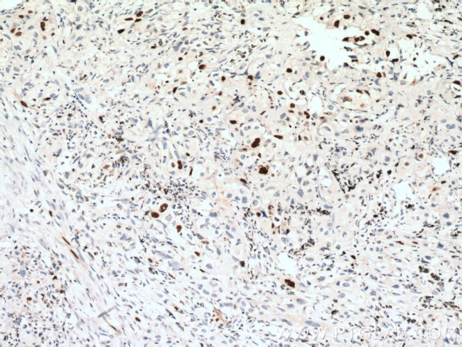 KI67 Antibody in Immunohistochemistry (Paraffin) (IHC (P))