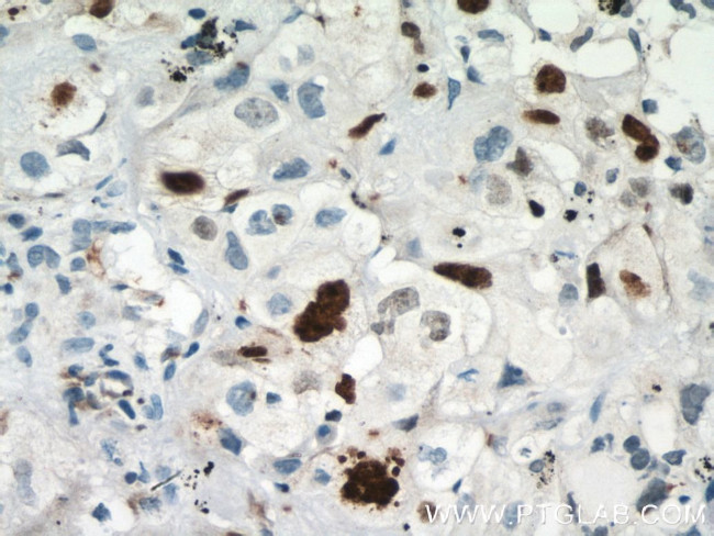 KI67 Antibody in Immunohistochemistry (Paraffin) (IHC (P))