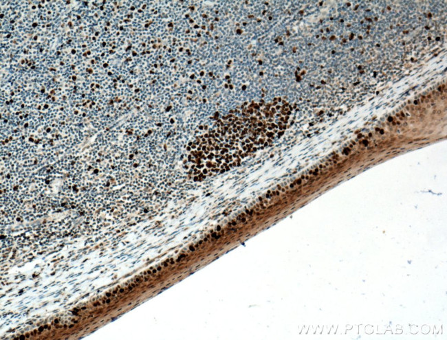 KI67 Antibody in Immunohistochemistry (Paraffin) (IHC (P))