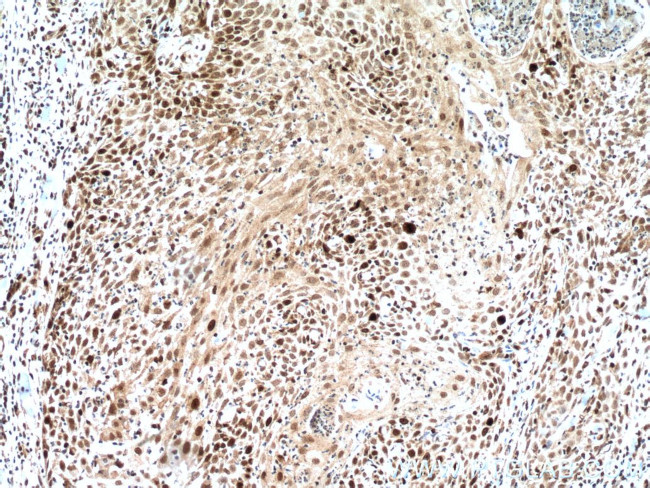 KI67 Antibody in Immunohistochemistry (Paraffin) (IHC (P))