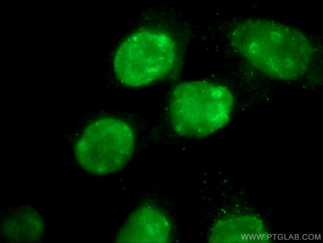 KI67 Antibody in Immunocytochemistry (ICC/IF)
