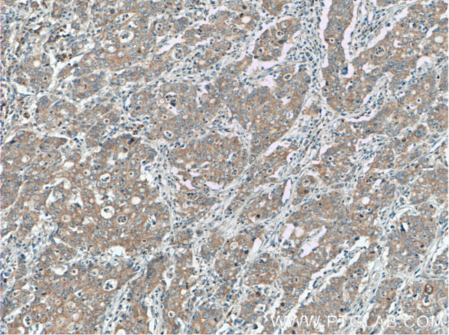 EDEM3 Antibody in Immunohistochemistry (Paraffin) (IHC (P))