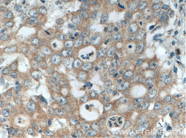 EDEM3 Antibody in Immunohistochemistry (Paraffin) (IHC (P))