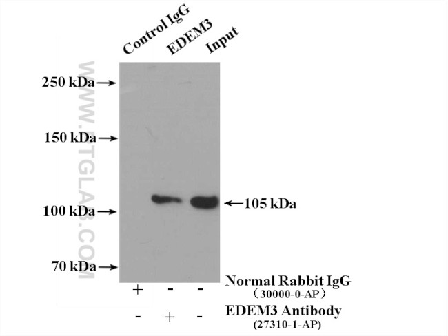 EDEM3 Antibody in Immunoprecipitation (IP)