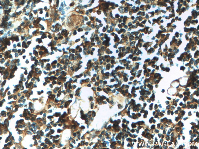 AAGAB Antibody in Immunohistochemistry (Paraffin) (IHC (P))