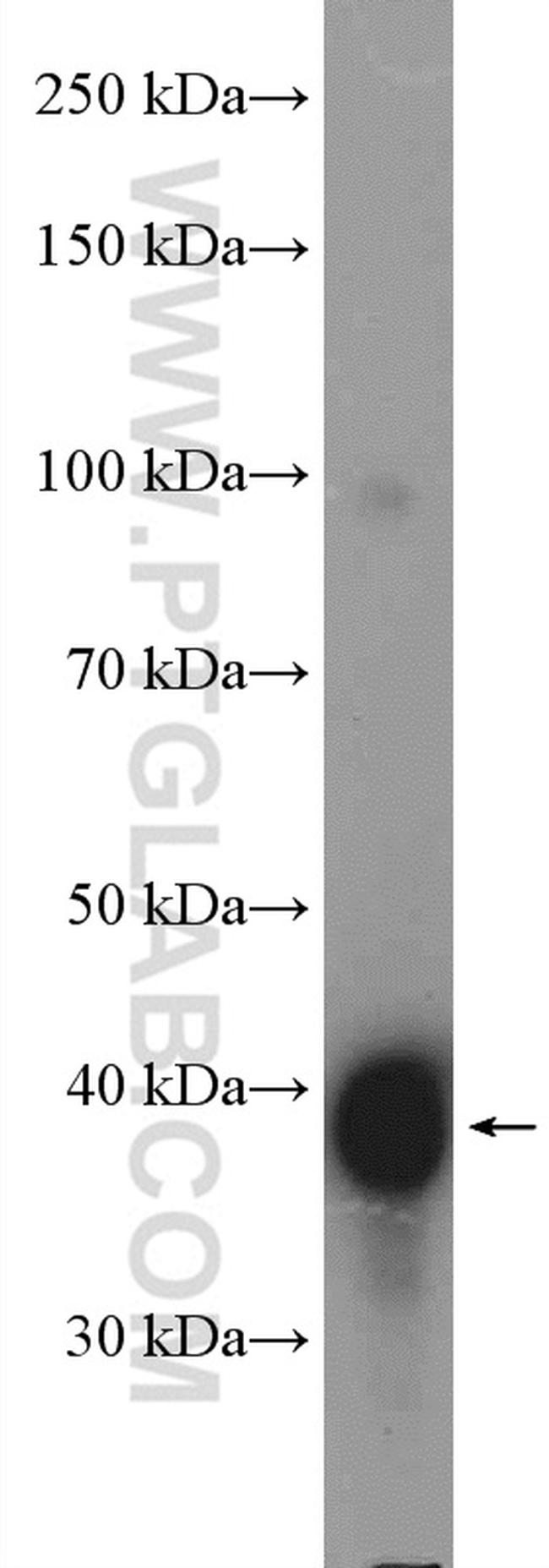 AAGAB Antibody in Western Blot (WB)