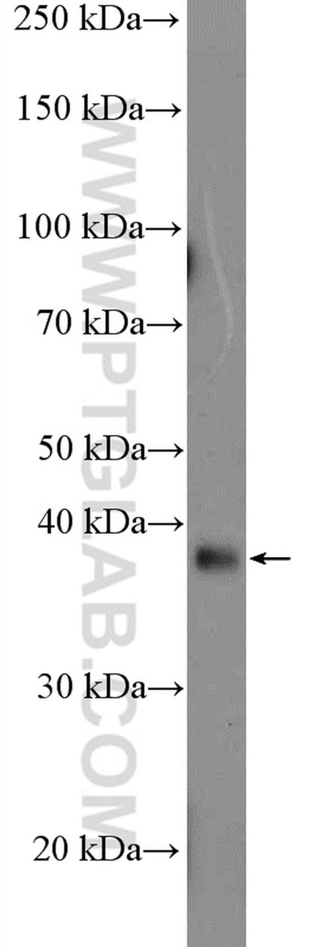 AAGAB Antibody in Western Blot (WB)