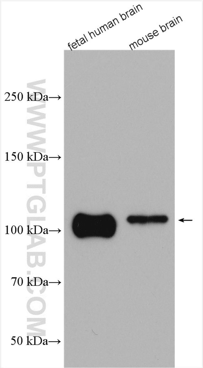 Beta Amyloid Antibody in Western Blot (WB)