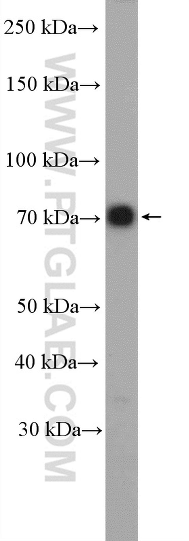 IFT74 Antibody in Western Blot (WB)