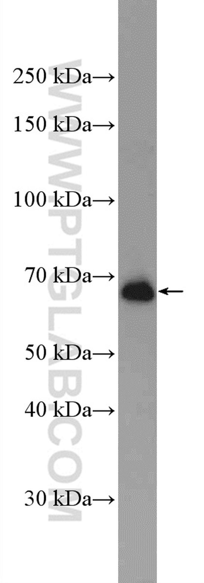 IFT74 Antibody in Western Blot (WB)