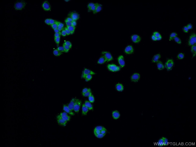 CNTF Antibody in Immunocytochemistry (ICC/IF)