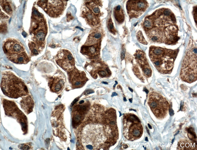 RARS Antibody in Immunohistochemistry (Paraffin) (IHC (P))