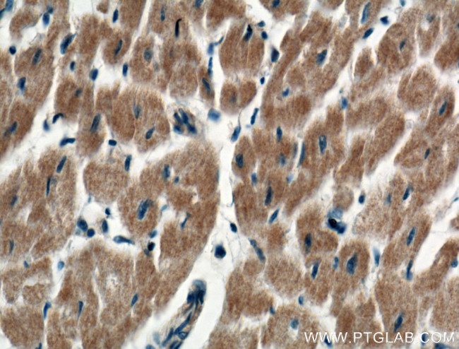 RARS Antibody in Immunohistochemistry (Paraffin) (IHC (P))