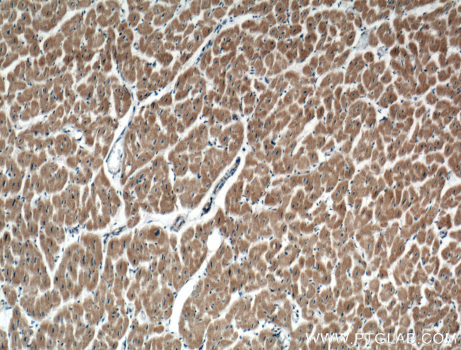 RARS Antibody in Immunohistochemistry (Paraffin) (IHC (P))