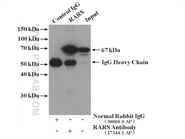 RARS Antibody in Immunoprecipitation (IP)