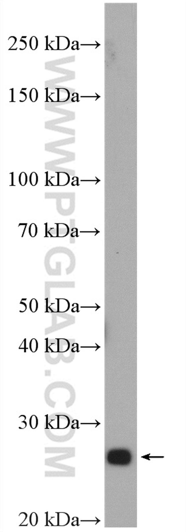 RAB33B Antibody in Western Blot (WB)