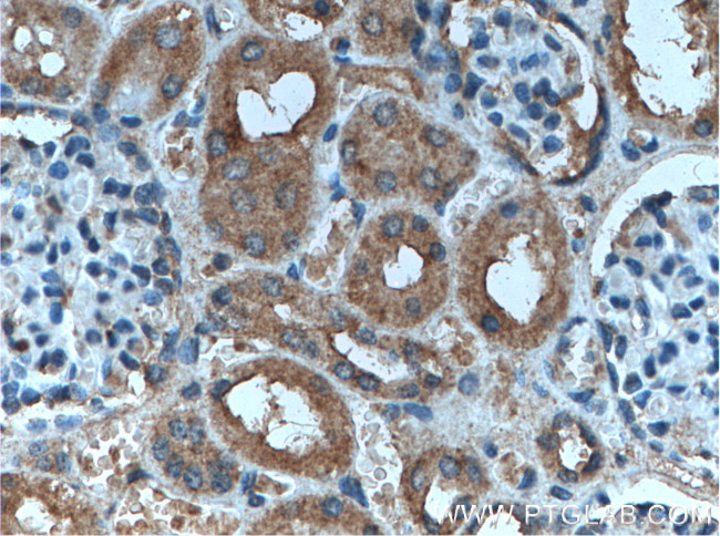 AP50 Antibody in Immunohistochemistry (Paraffin) (IHC (P))