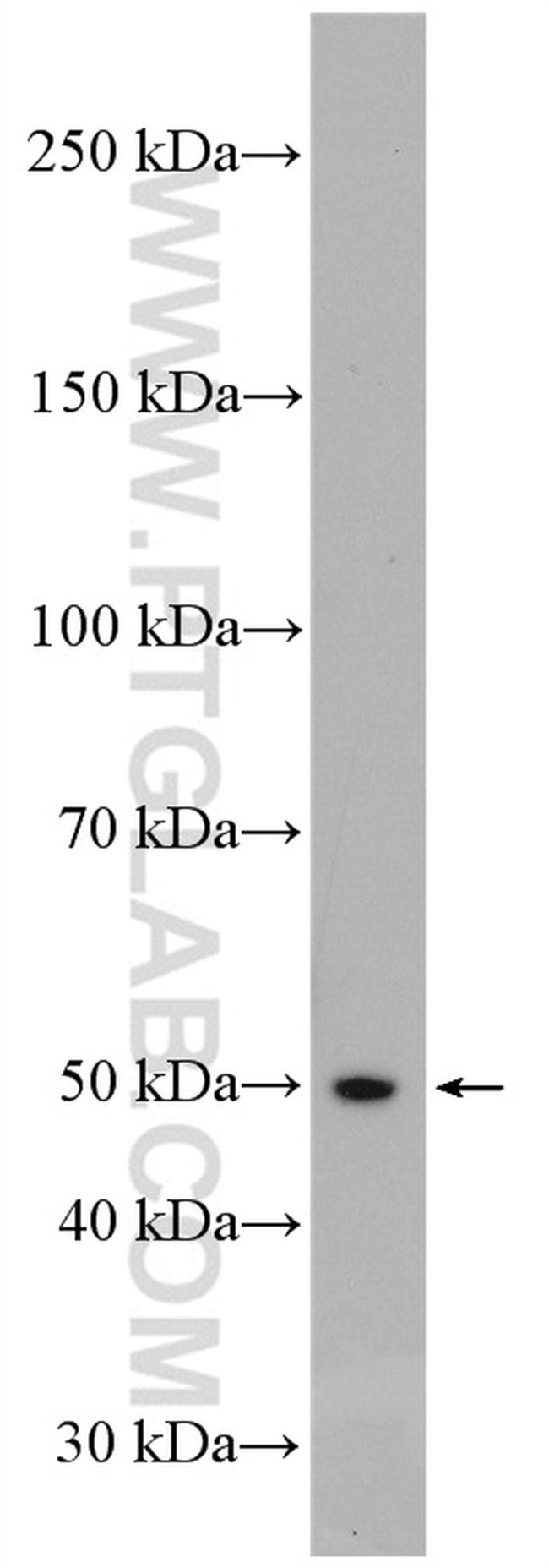 AP50 Antibody in Western Blot (WB)