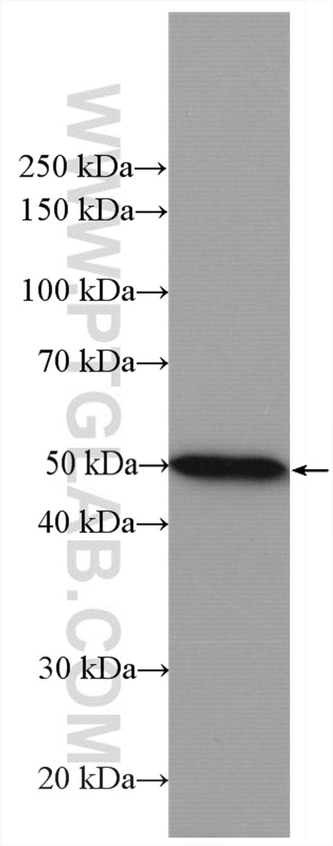 AP50 Antibody in Western Blot (WB)