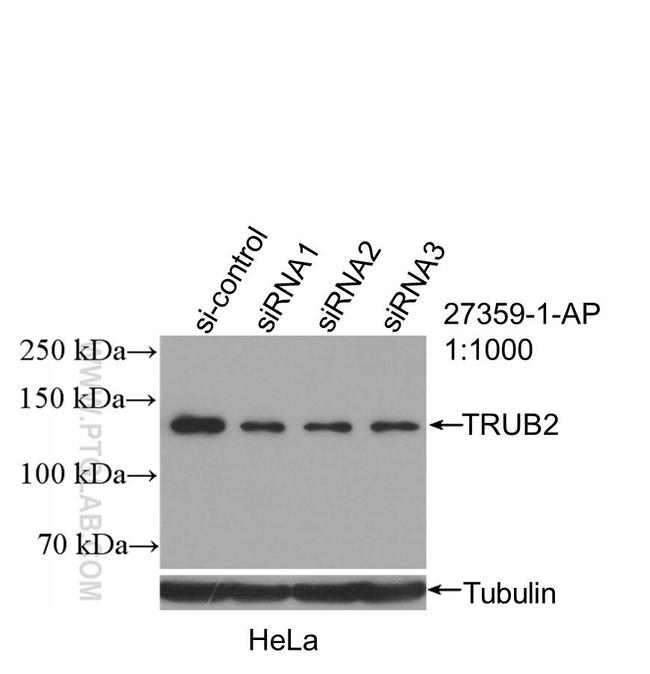 SEMA4A Antibody in Western Blot (WB)