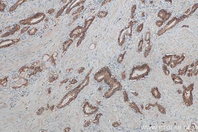 TACSTD2/TROP2 Antibody in Immunohistochemistry (Paraffin) (IHC (P))