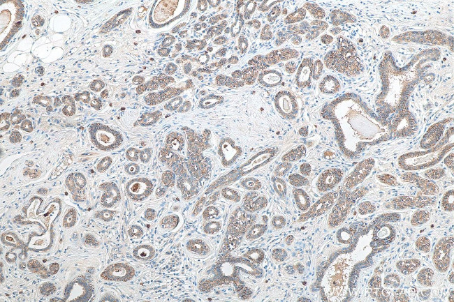 TACSTD2/TROP2 Antibody in Immunohistochemistry (Paraffin) (IHC (P))