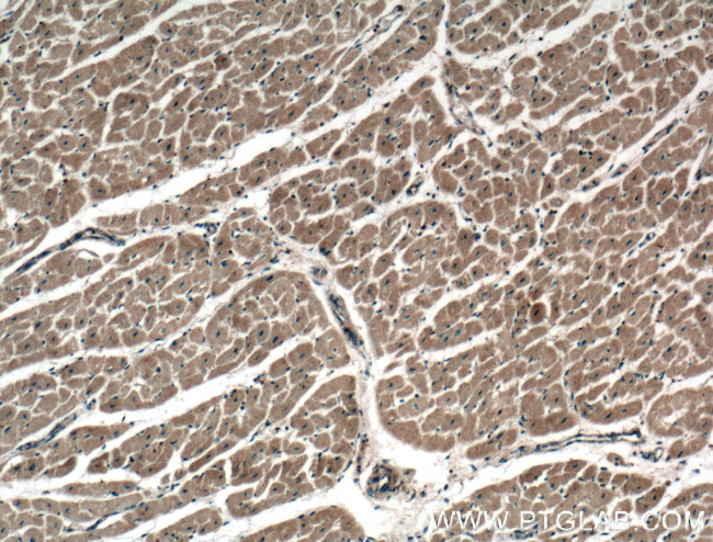 ADAL Antibody in Immunohistochemistry (Paraffin) (IHC (P))