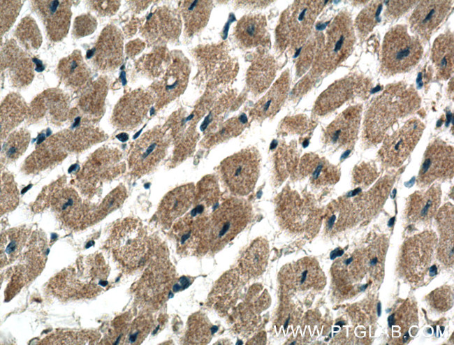 ADAL Antibody in Immunohistochemistry (Paraffin) (IHC (P))