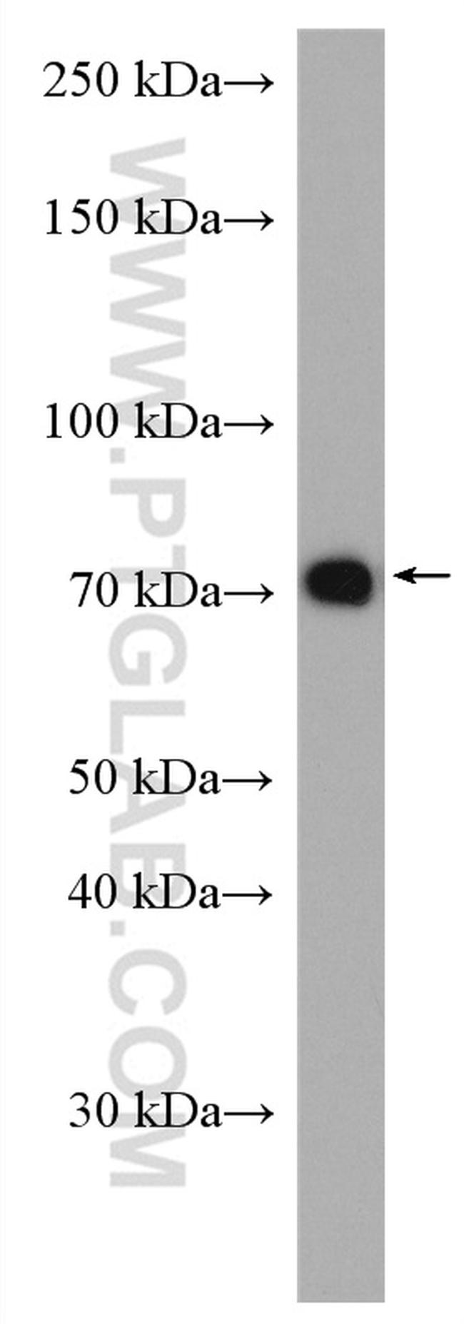 IL2RG Antibody in Western Blot (WB)