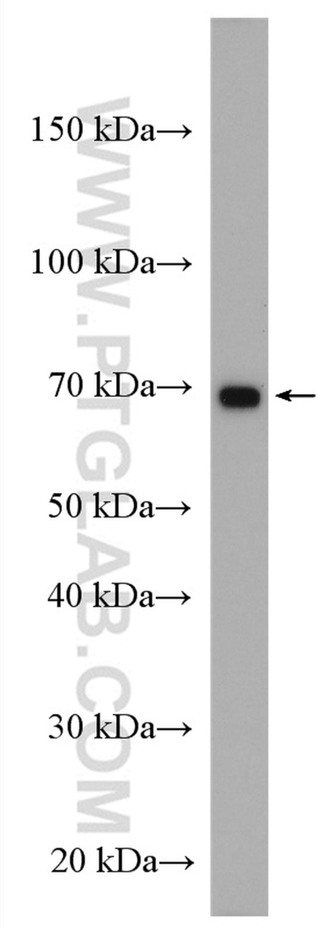 IL2RG Antibody in Western Blot (WB)