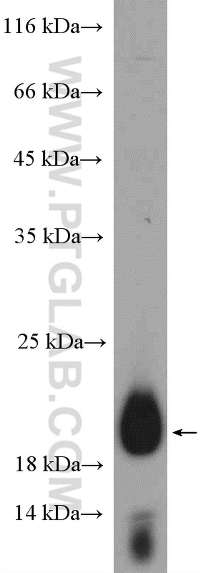 C19orf12 Antibody in Western Blot (WB)