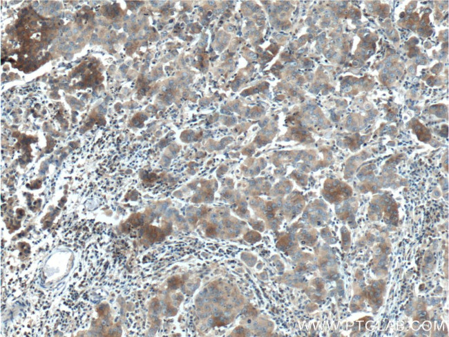 DVL1 Antibody in Immunohistochemistry (Paraffin) (IHC (P))