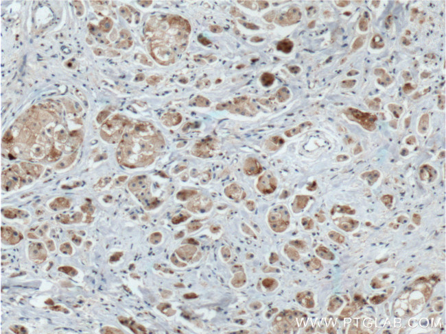 DVL1 Antibody in Immunohistochemistry (Paraffin) (IHC (P))